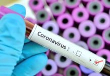 Covid-19 en Guinée : 91 cas d’infection sur 1 656 personnes testées