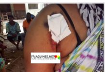 Fria: »Les gendarmes m’ont battue comme une chienne » témoigne une femme