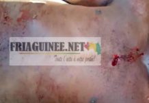 Conakry: un jeune tué par balle à Bantounkan